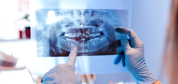 UNEATLANTICO auspicia un estudio sobre detección de afecciones dentales a través de IA y rayos X